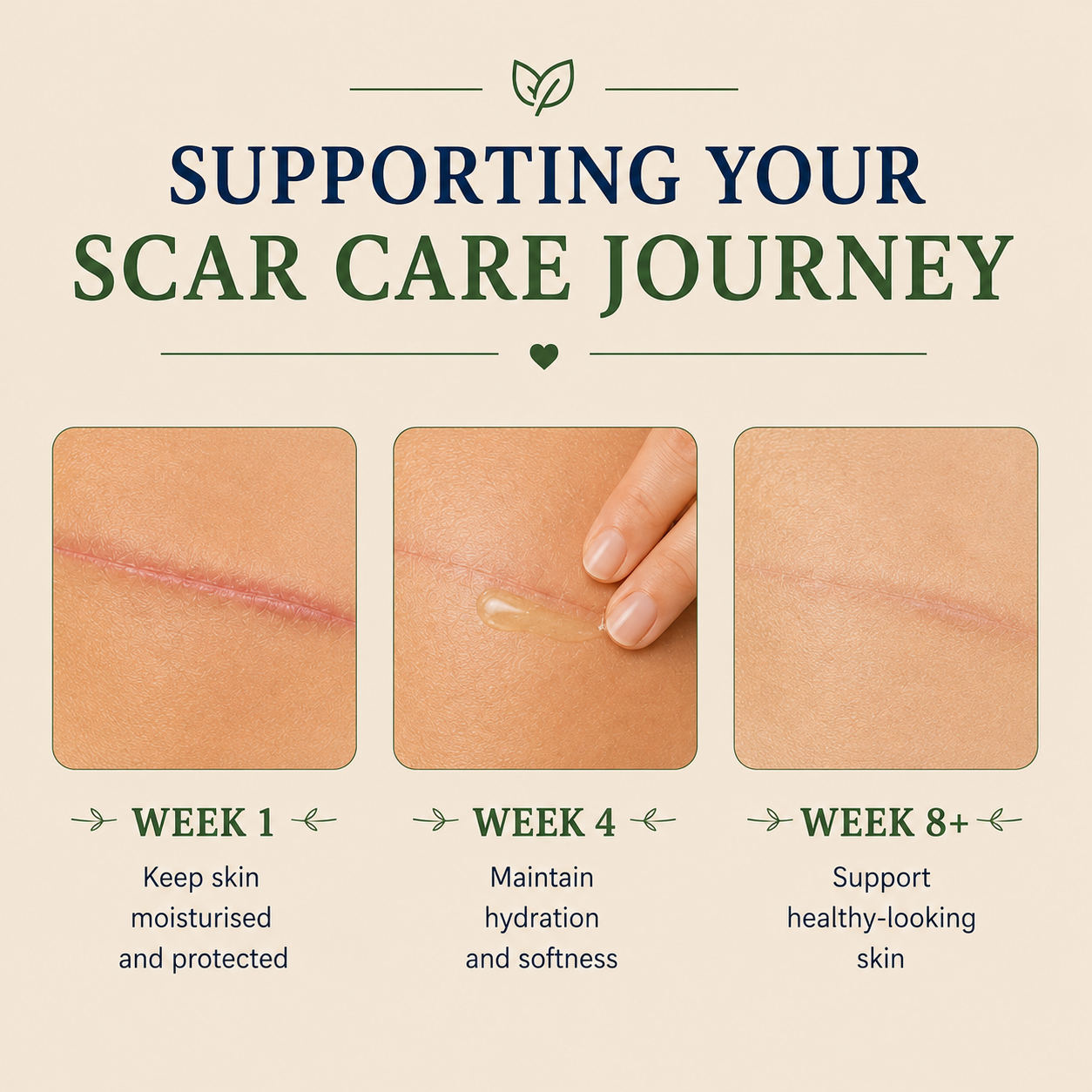 C-Section &amp; Scar Balm 50ml
